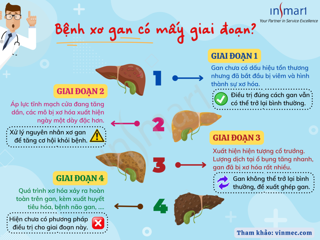 4. Điều trị cổ chướng kháng trị bằng TIPS