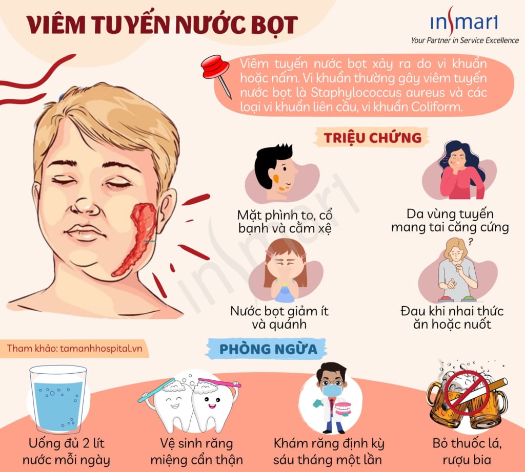 4. Phòng ngừa viêm tuyến nước bọt